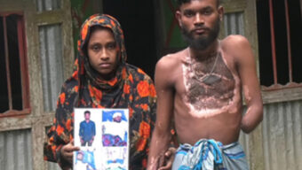 বিদ্যুৎস্পৃষ্টে থমকে গেছে মিরাজের জীবন