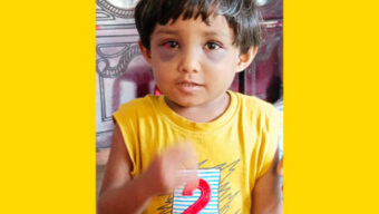 ঝালকাঠিতে ৪ বছরের শিশুর ওপর নির্যাতনে অভিযুক্ত বাবা ও সৎ মা