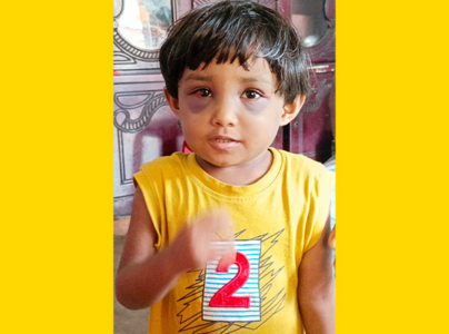 ঝালকাঠিতে ৪ বছরের শিশুর ওপর নির্যাতনে অভিযুক্ত বাবা ও সৎ মা